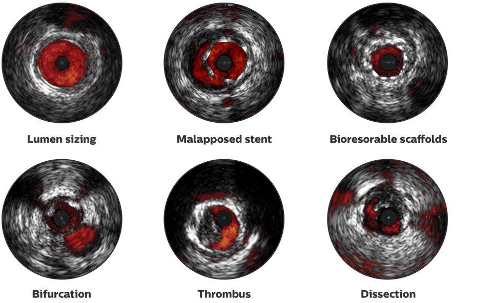 chromaflo imaging