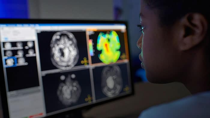 Enhancing brain tumor MRI with APT weighted imaging